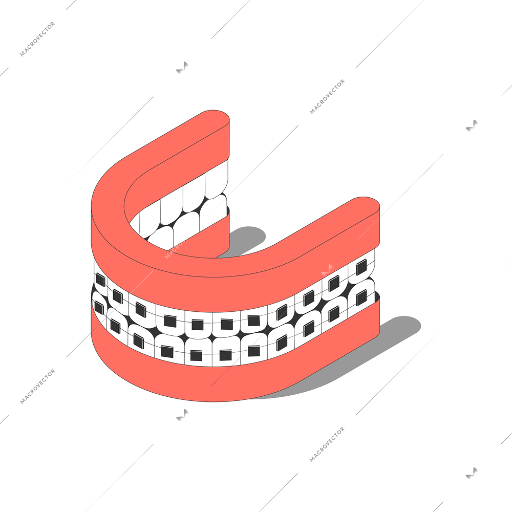 Dental prosthesis with braces 3d isometric icon vector illustration