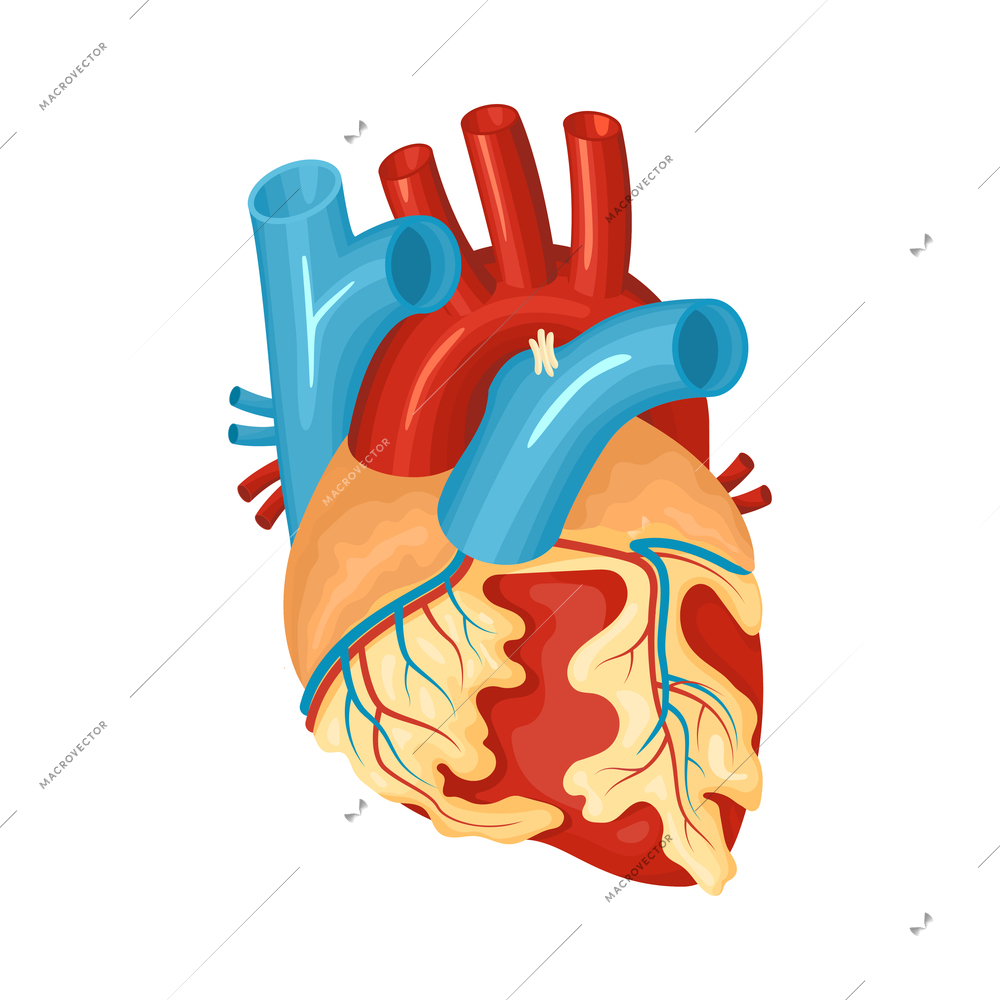 Anatomy of diseased heart flat vector illustration