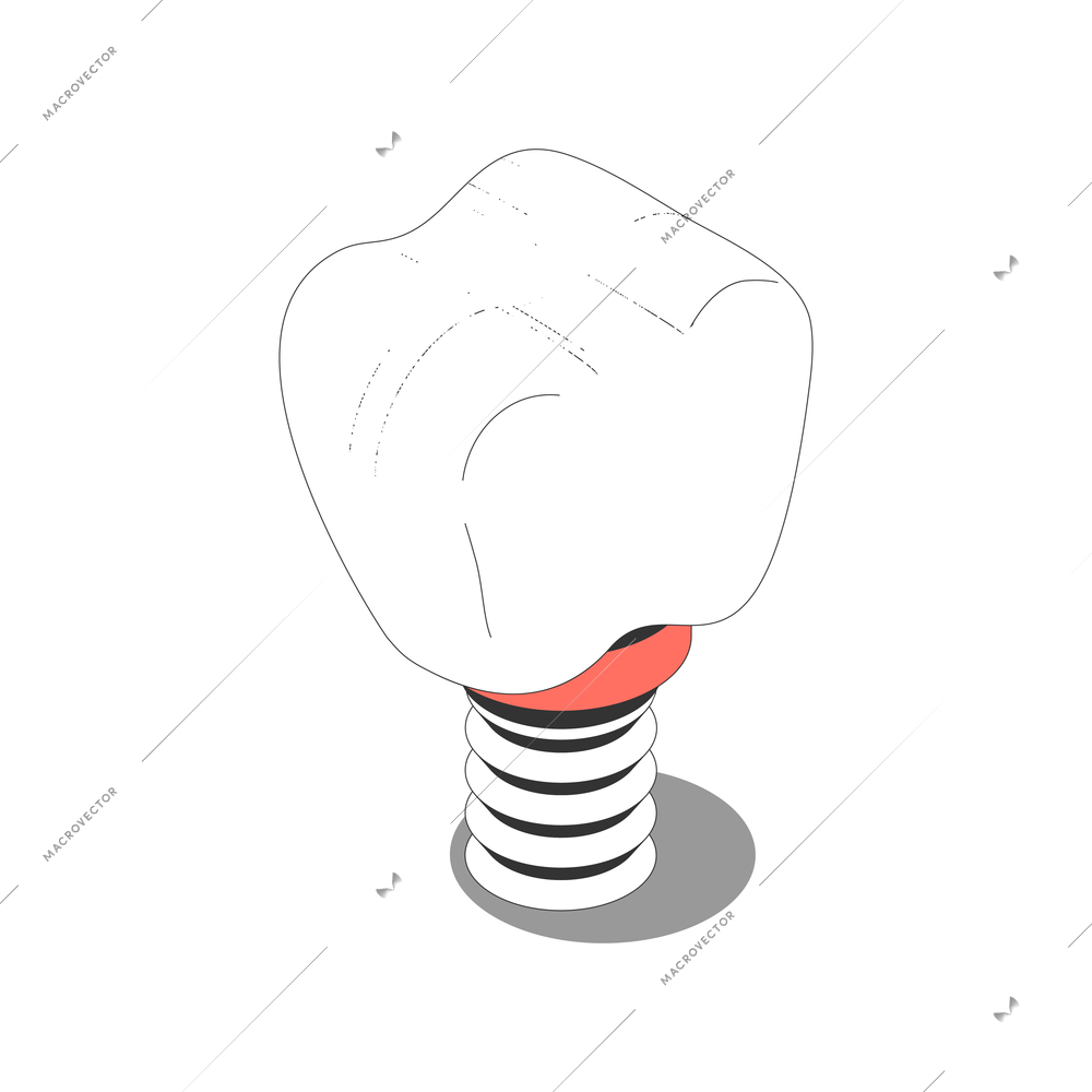 Isometric icon with human tooth on dental post 3d vector illustration