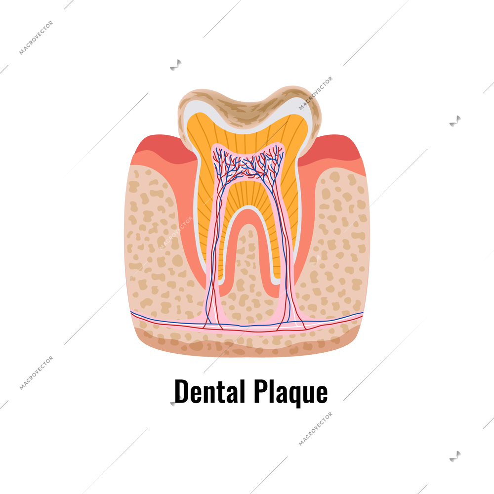 Dental plague tooth anatomy flat poster vector illustration