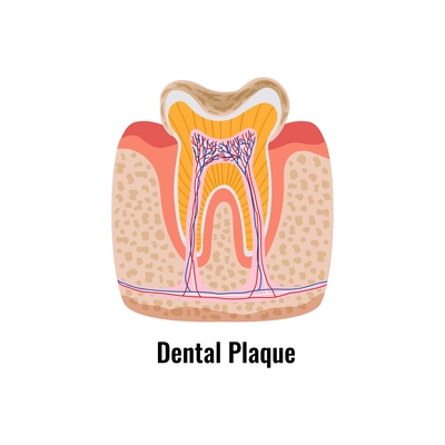 Dental plague tooth anatomy flat poster vector illustration