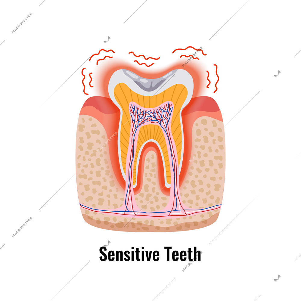 Dental problem poster with flat sensitive tooth anatomy vector illustration