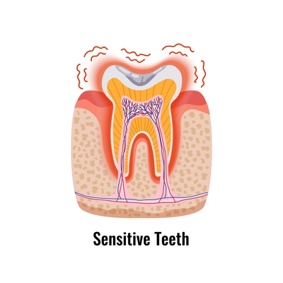 Dental problem poster with flat sensitive tooth anatomy vector illustration