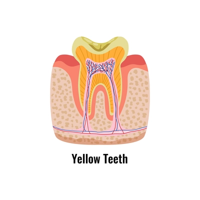 Dental oral problems poster with yellow tooth anatomy flat vector illustration