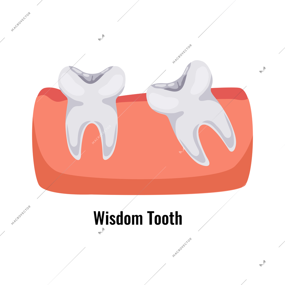 Wisdom tooth poster in flat style vector illustration