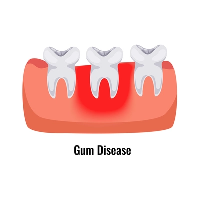 Dental oral problems flat poster with gum disease vector illustration
