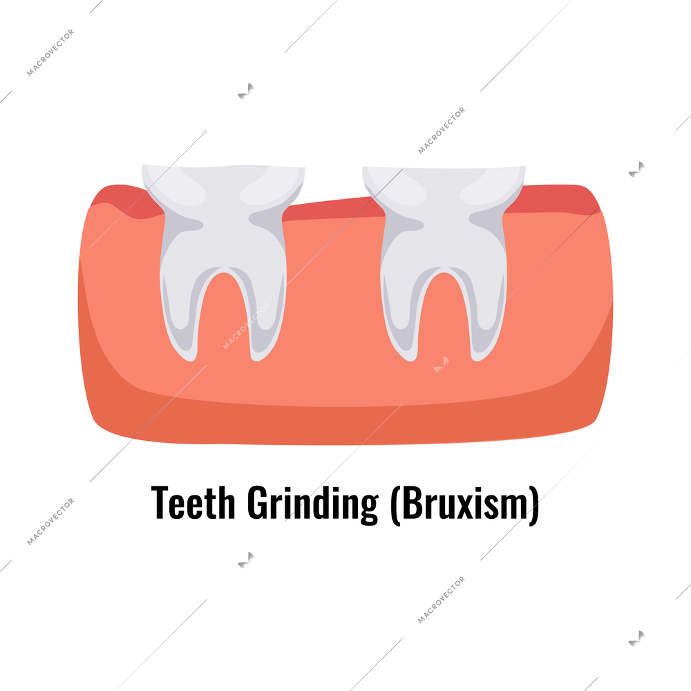 Dental oral problem poster with bruxism teeth grinding flat vector illustration
