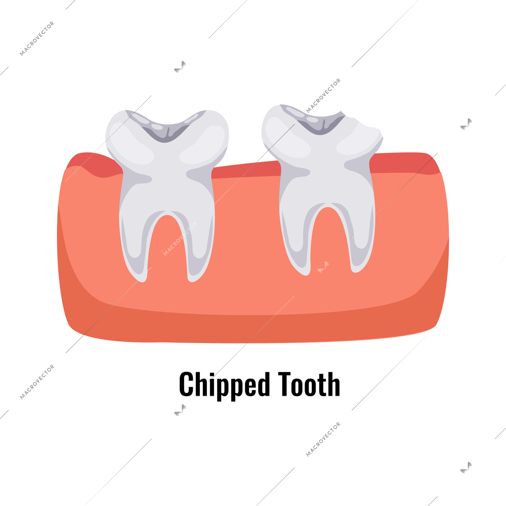 Dental oral problems flat poster with chipped tooth vector illustration