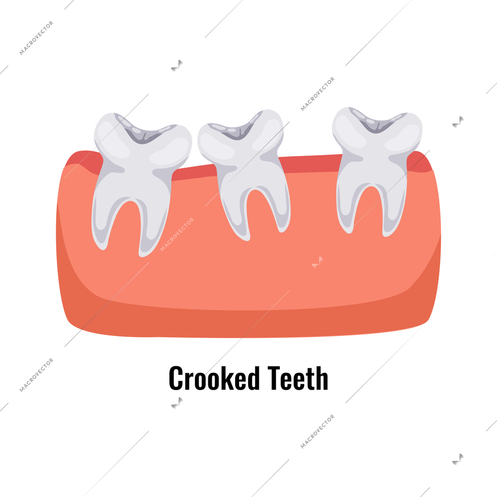 Dental oral problem poster with crooked teeth flat vector illustration