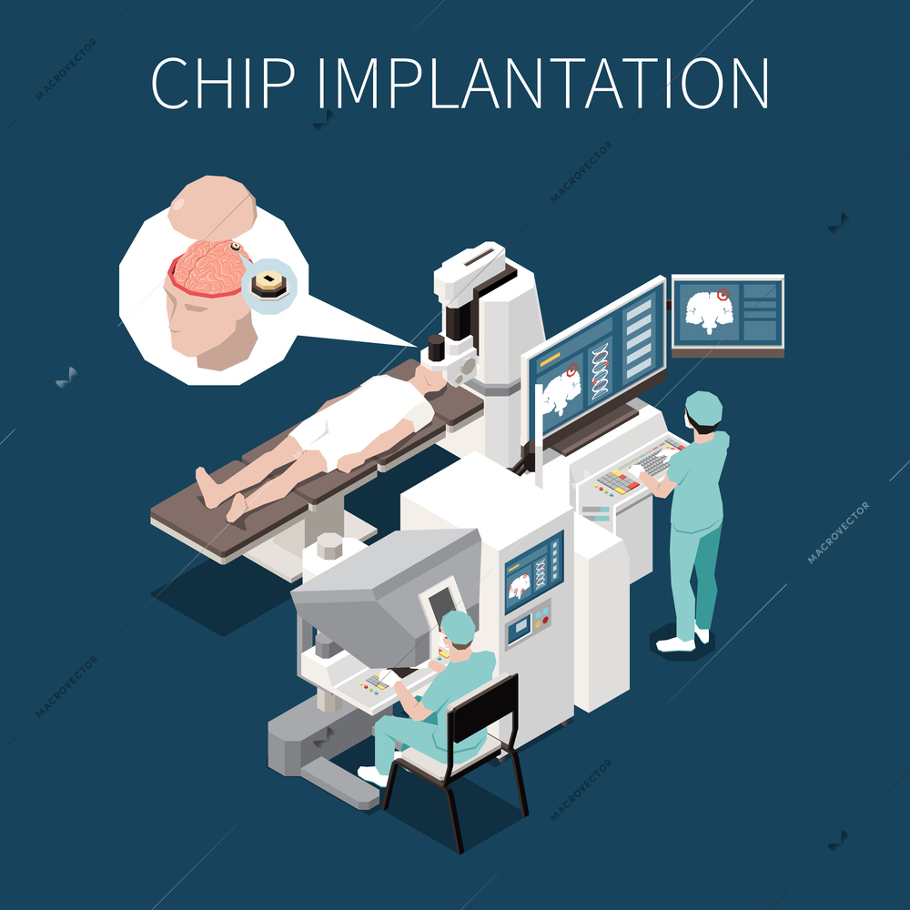 Chip implantation isometric background illustrated high tech surgery operation of implant installation into human brain vector illustration