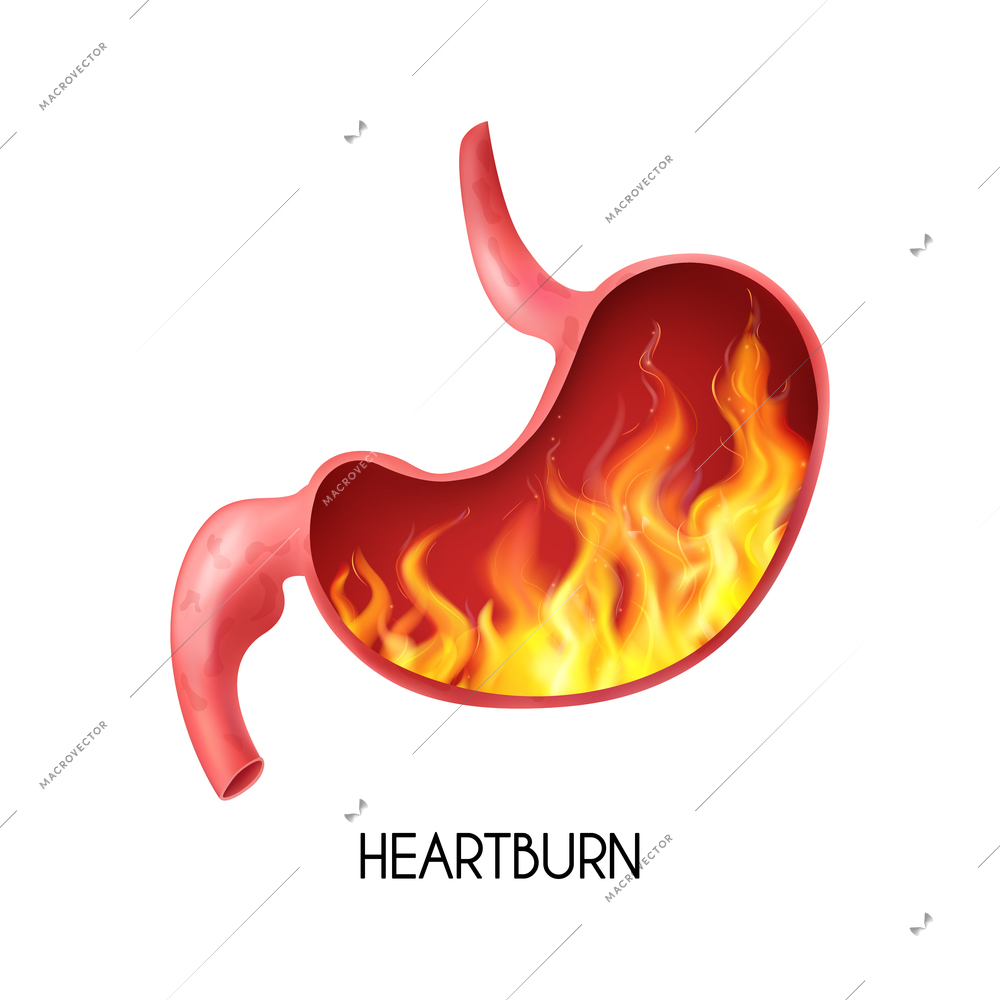 Realistic human internal organ stomach with heartburn on white background vector illustration