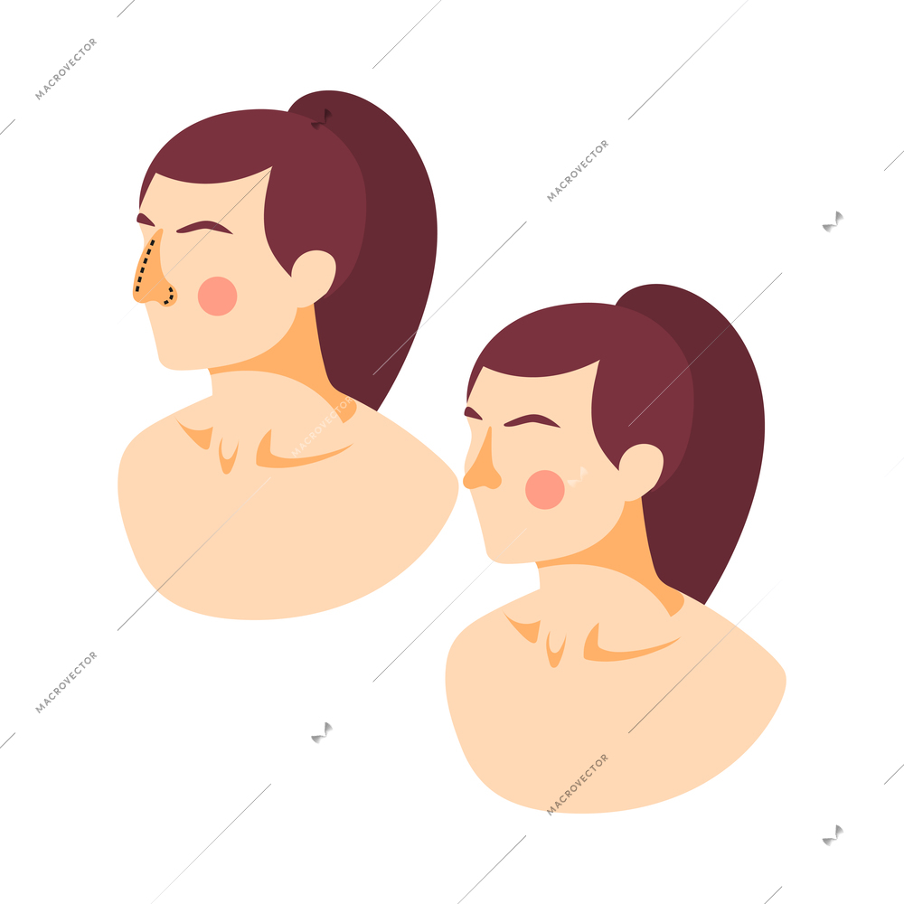 Plastic surgery icon with female face before and after rhinoplasty operation isometric vector illustration