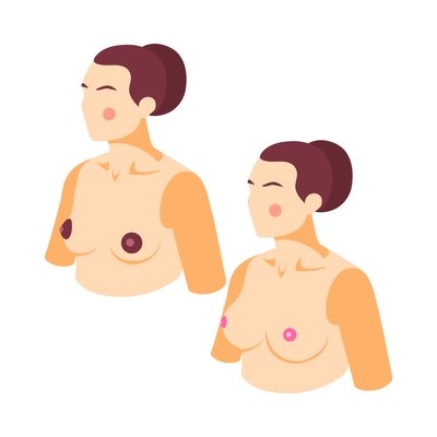 Plastic surgery icon with woman before and after breasts correction 3d vector illustration