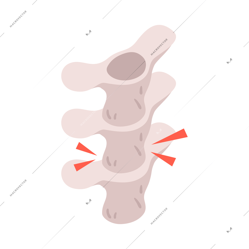 Isometric neurological neurology composition with isolated image of human spine with damage marks on blank background vector illustration