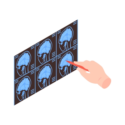 Isometric neurological neurology composition with isolated image of brain radiogram with doctors hand holding pen vector illustration