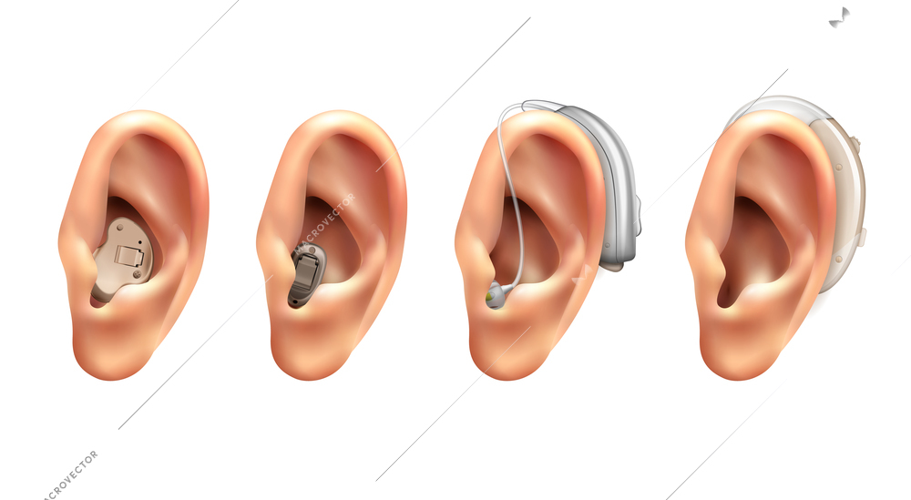 Hearing aid ear realistic set of four isolated images with human ears with hanging electronic appliances vector illustration