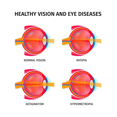 Human eye anatomy set with vision disorders symbols isometric isolated vector illustration