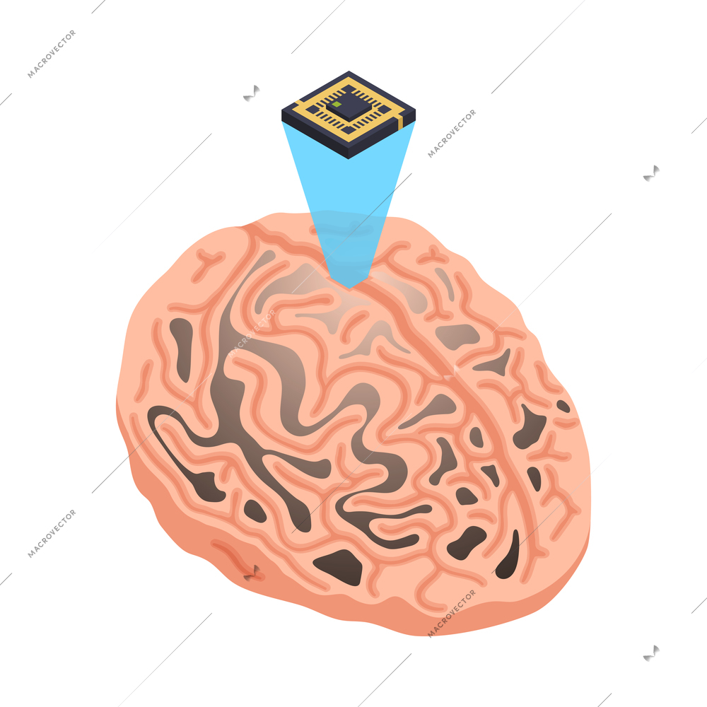 Neurology and neural surgery isometric composition with medical innovations isolated image vector illustration