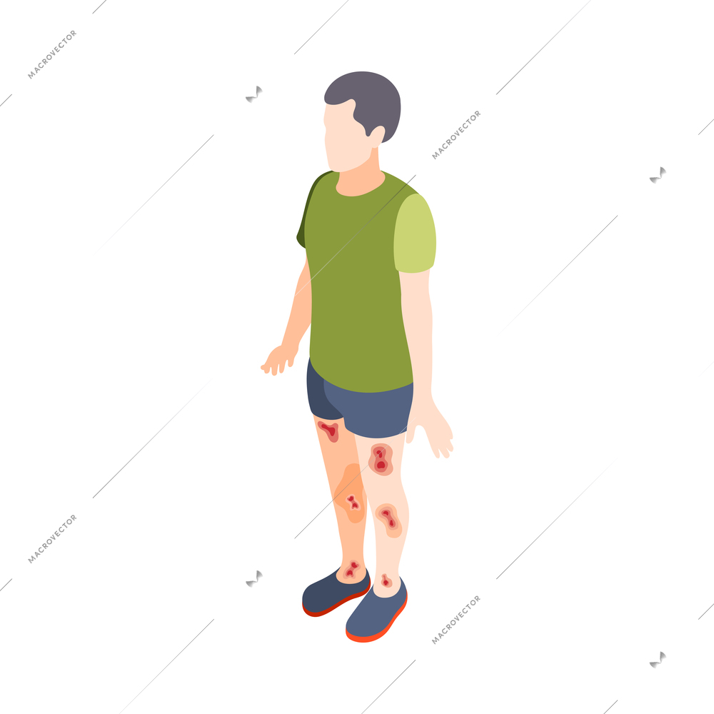 Diabetes isometric composition with isolated human character of suffering person vector illustration