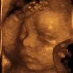 Specialist Women's Ultrasound image 3