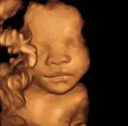 Castleton HD Ultrasound logo