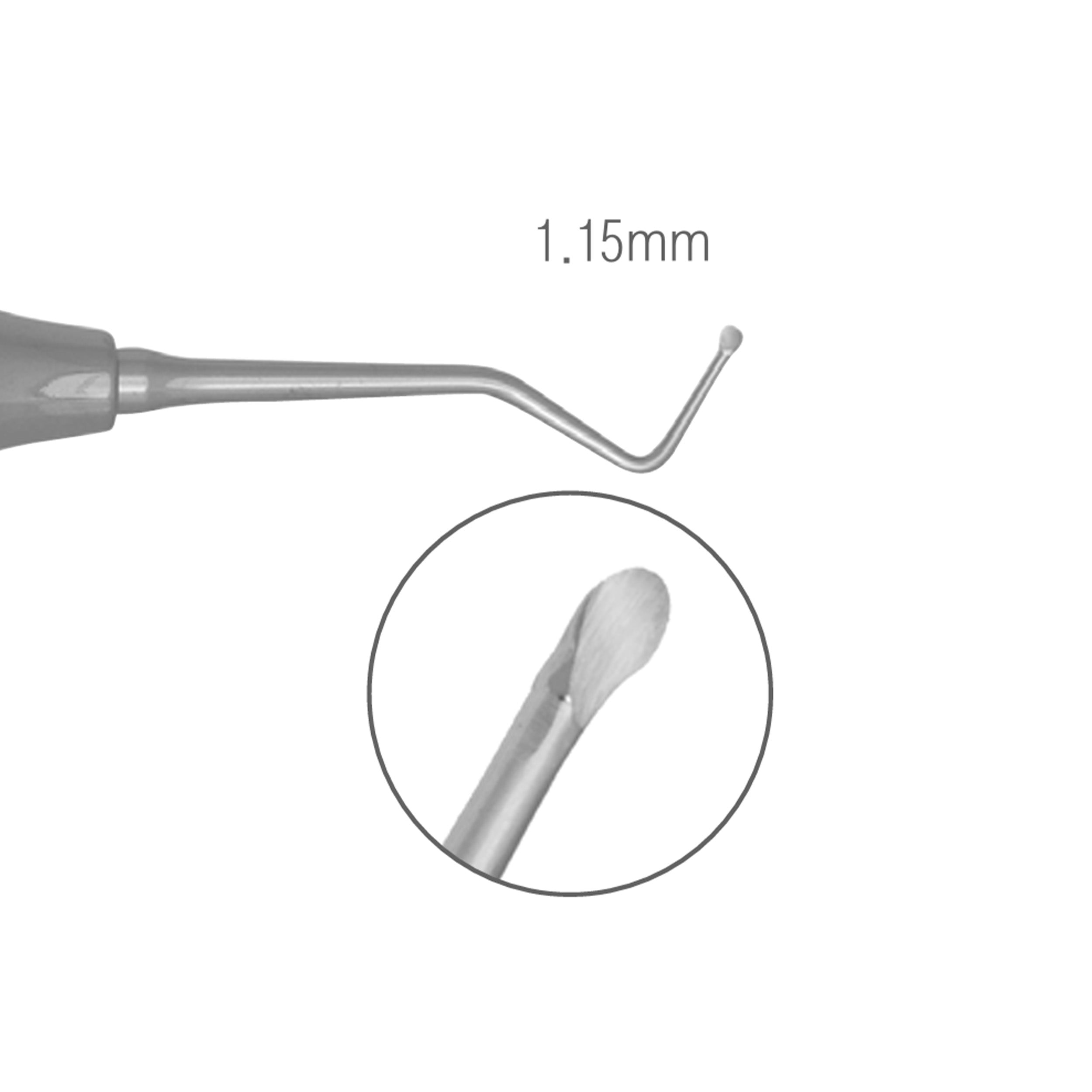 Nordent DuraLite Excavator Spoon #127-128 Double End Round Handle