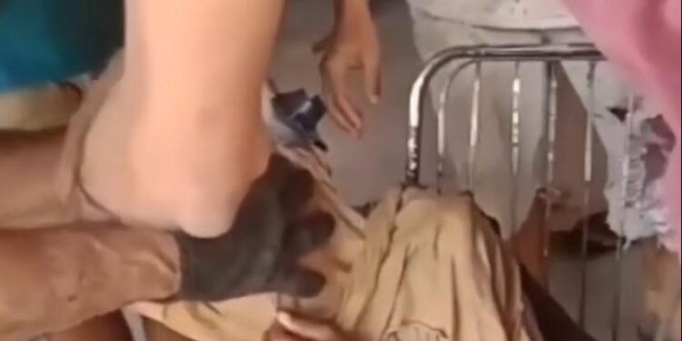 Moradores de Coroatá socorrem criança com panela de pressão presa na cabeça