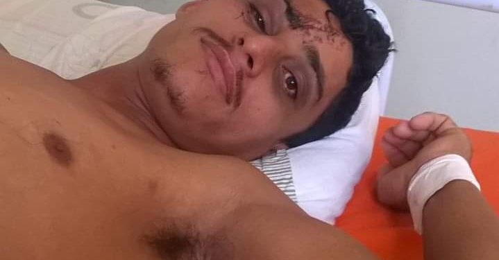 Pais de jovem de Grajaú pedem ajuda para pagar segunda cirurgia do filho após acidente