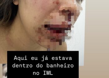 Homem é preso após agredir a namorada em Imperatriz