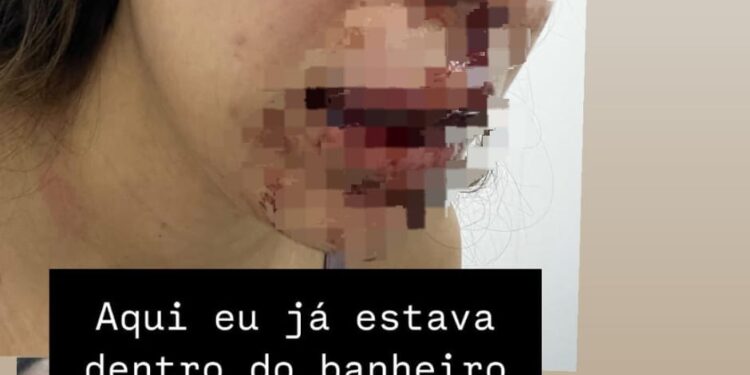 Homem é preso após agredir a namorada em Imperatriz