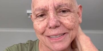 Roseana Sarney relata crise alérgica durante tratamento contra câncer e relembra conselho da mãe: “Reaja, enfrente o tratamento com coragem”