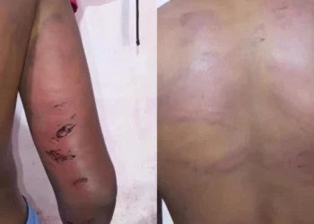 Policial é afastado e investigado por tortura contra adolescente no MA