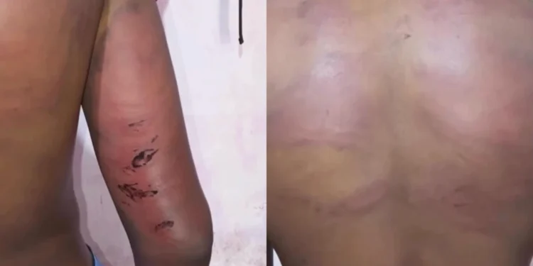 Policial é afastado e investigado por tortura contra adolescente no MA