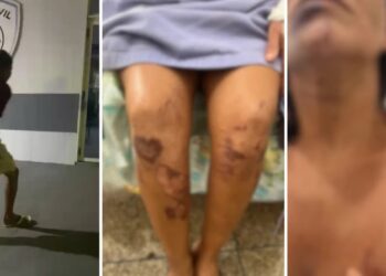 Mulher é atacada por homem com socos e chutes e sofre tentativa de abuso em Alto Alegre do Pindaré; suspeito é preso