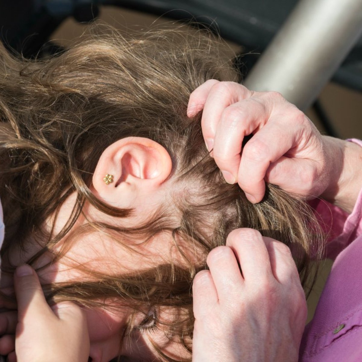Head lice treatment: Why do we get head lice and how to prevent them.