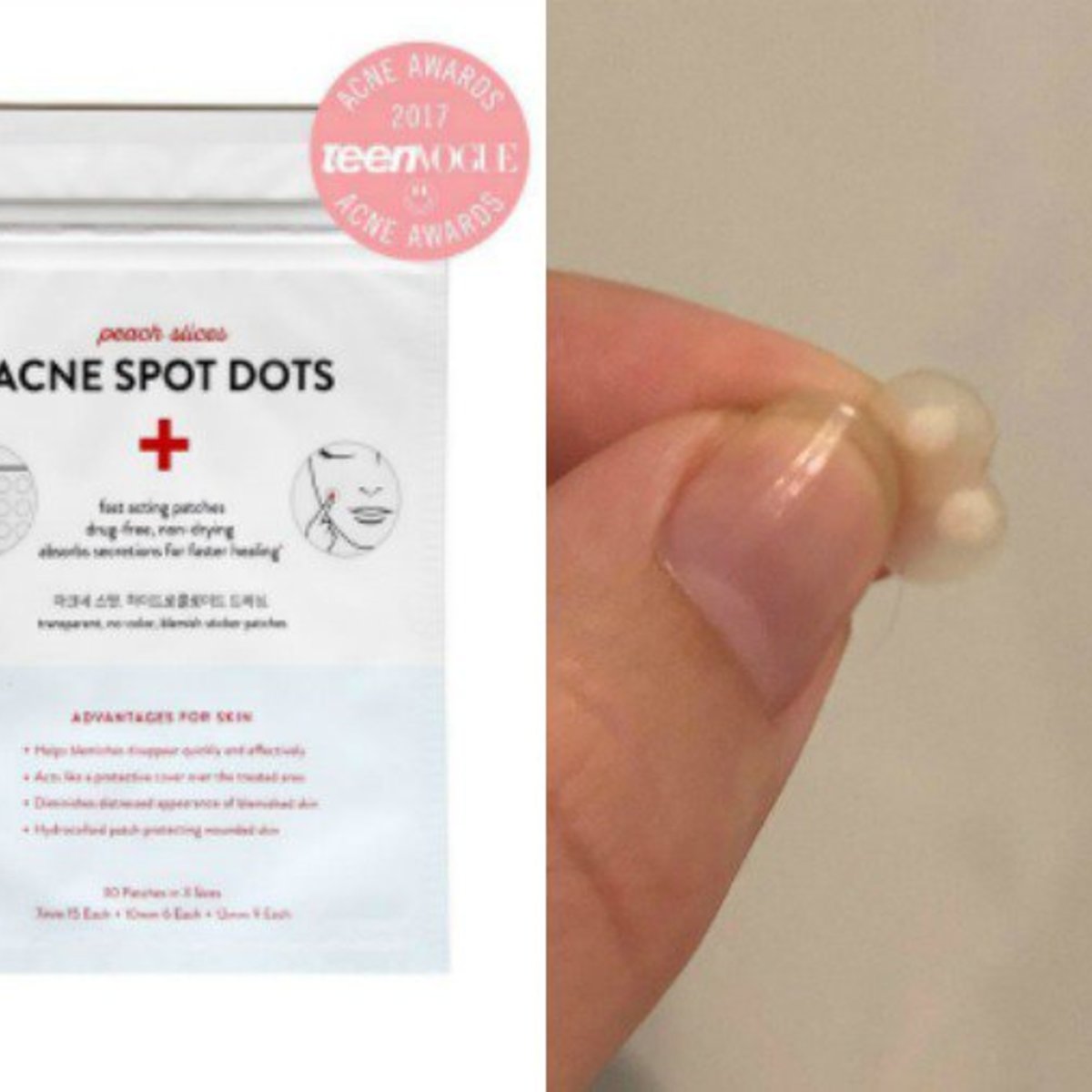 An Editor's Review of Dots for Spots Pimple Patches