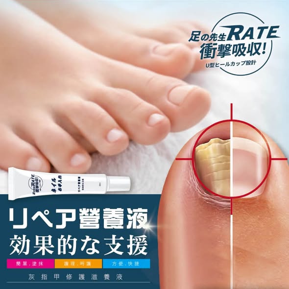  足の先生 台灣GMP廠 灰指甲修護滋養液 30ml $99 