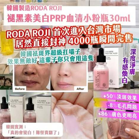 20-63233 韓國製造RODA ROJI 褪黑素美白PRP血 清小粉瓶30ml