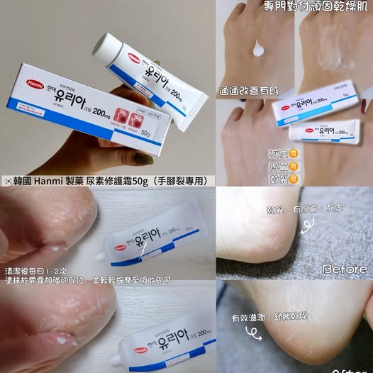 01-12799 韓國 Hanmi 製藥 尿素修護霜50g(手腳裂專用