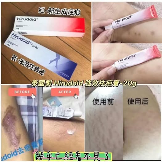 01-219 泰國製 Hirudoid 強效祛疤膏20g