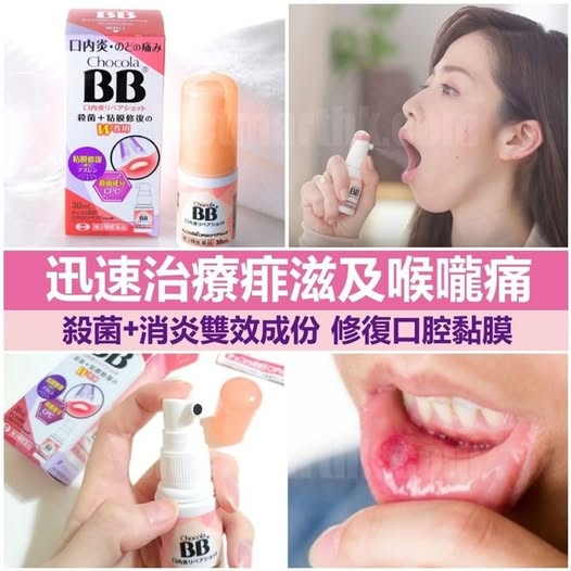 49-78A-16158 日本🌸Chocola BB 口內炎 噴霧 30ml 