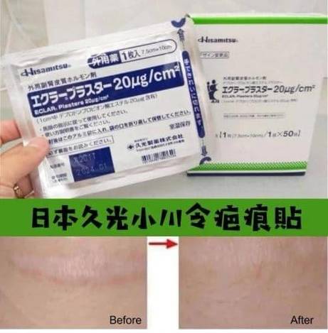 日本 久光製藥小川令疤痕貼1217