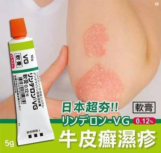 牛皮癬濕疹VG軟膏C*0205
