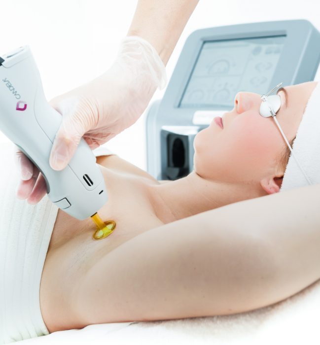 Laser αποτρίχωση στην μασχάλη με 100% ασφάλεια.