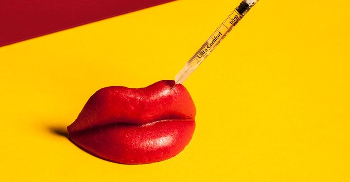 «FILLER FATIGUE»…ΤΙ ΣΥΜΒΑΙΝΕΙ ΑΠΟ ΤΗΝ ΥΠΕΡΒΟΛΙΚΗ ΧΡΗΣΗ ΥΑΛΟΥΡΟΝΙΚΟΥ ΣΤΟ ΠΡΟΣΩΠΟ?