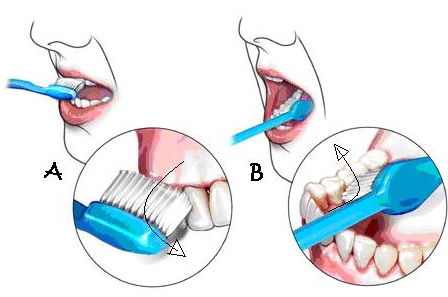 Gambar  Cara Menyikat  Gigi  Yang Baik Dan Benar Bagi Hal Baik