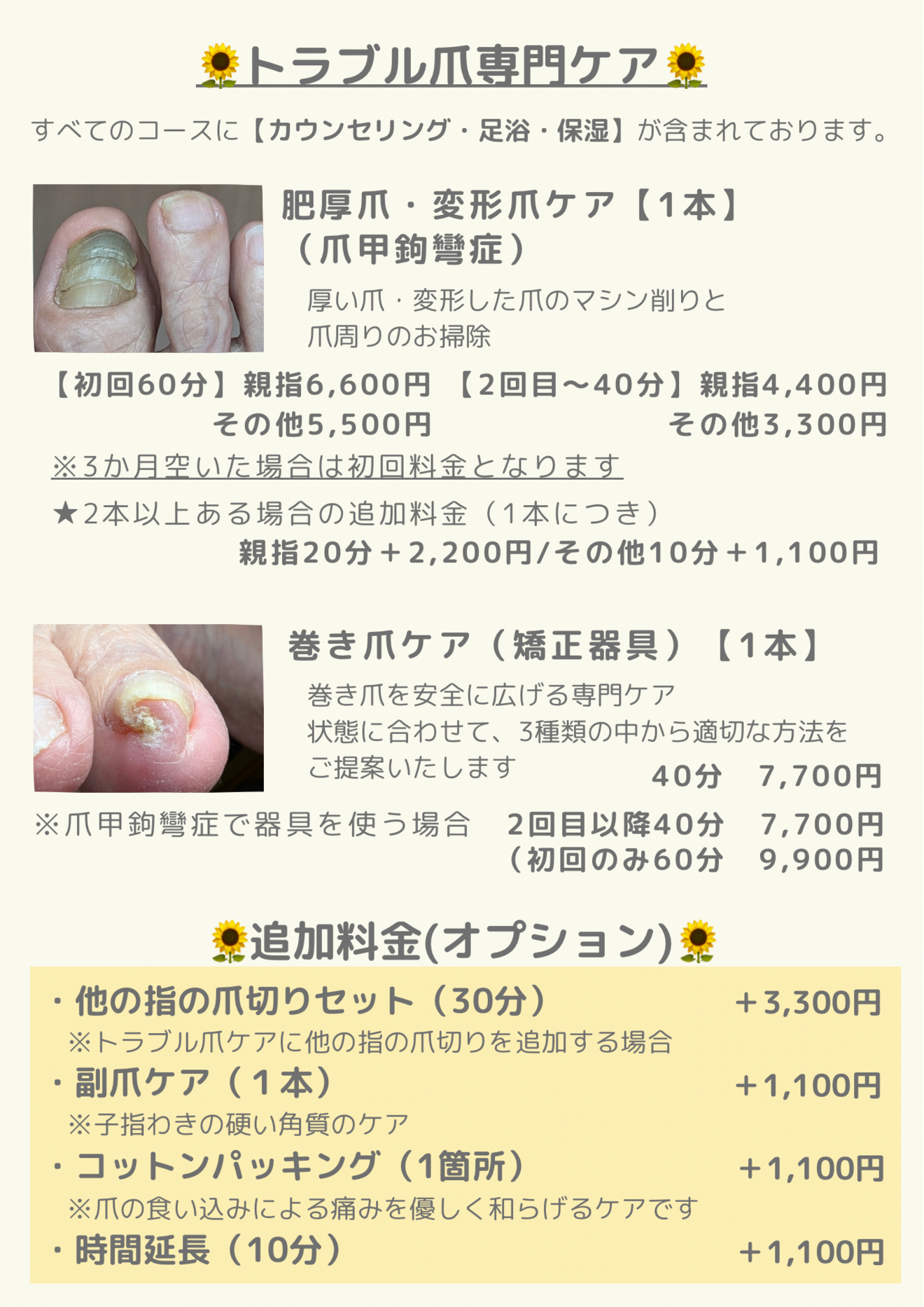 看護師の爪切り店🌻ひまわり　那珂市