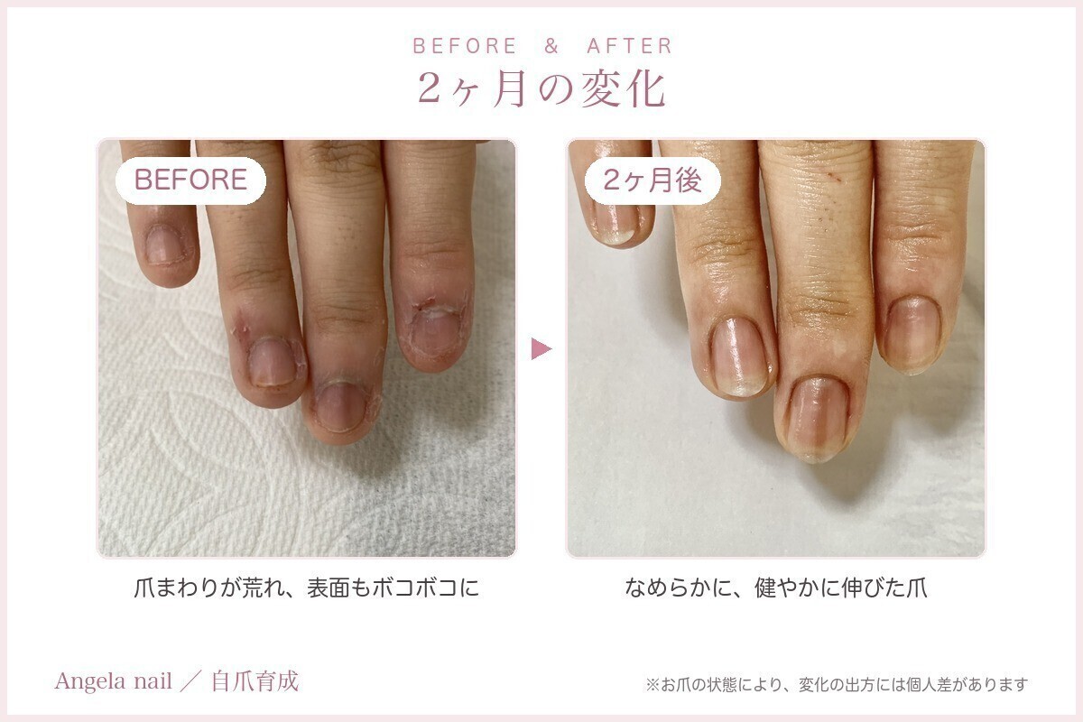アンジェラネイル🌸自爪育成【名取市】