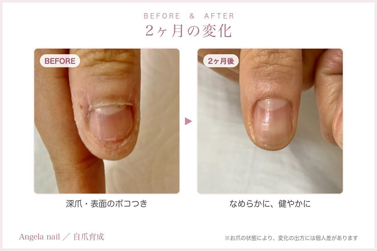 アンジェラネイル🌸自爪育成【名取市】