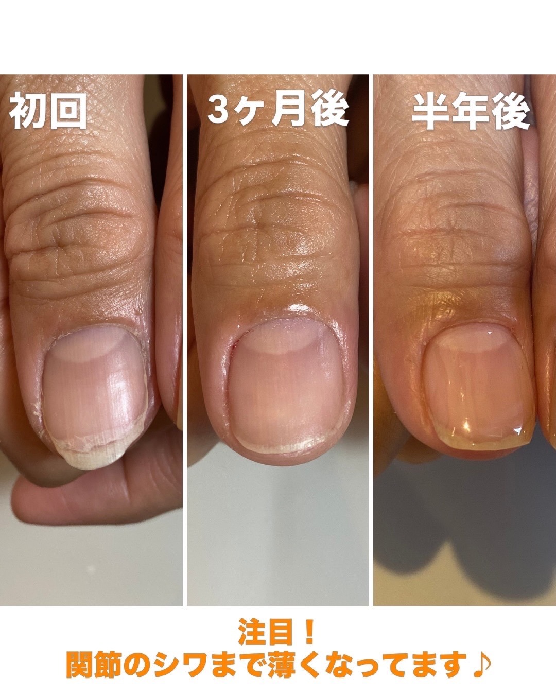 爪を育てるネイルサロン ネイル アイリー